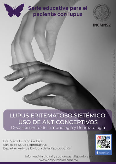 Lupus eritematoso sistémico: Uso de anticonceptivos