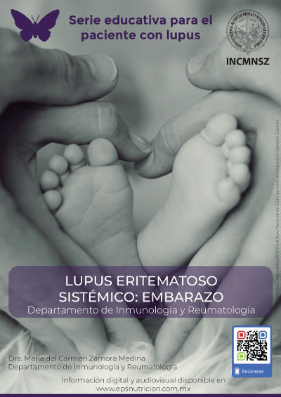 Lupus eritematoso sistémico: Embarazo