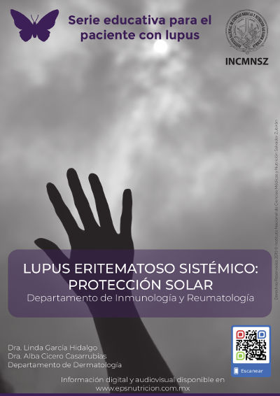 Lupus eritematoso sistémico: Protección solar