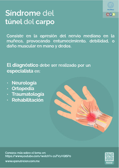 Síndrome del túnel del carpo